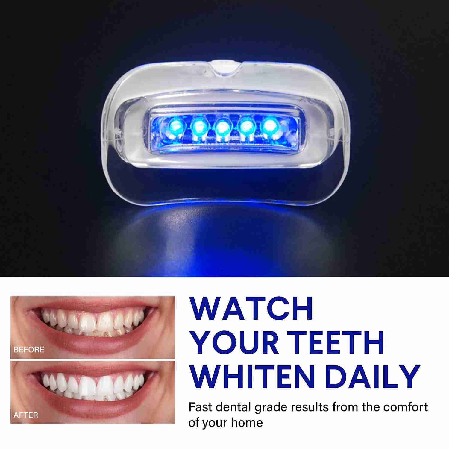 pearly-white-smile-whitening-kit for cheap