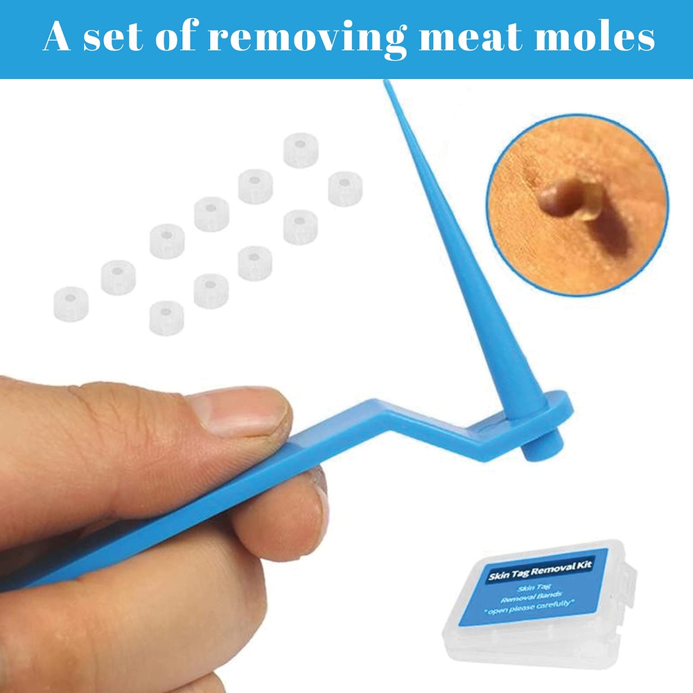 Skin-Tag-Remover with discount code