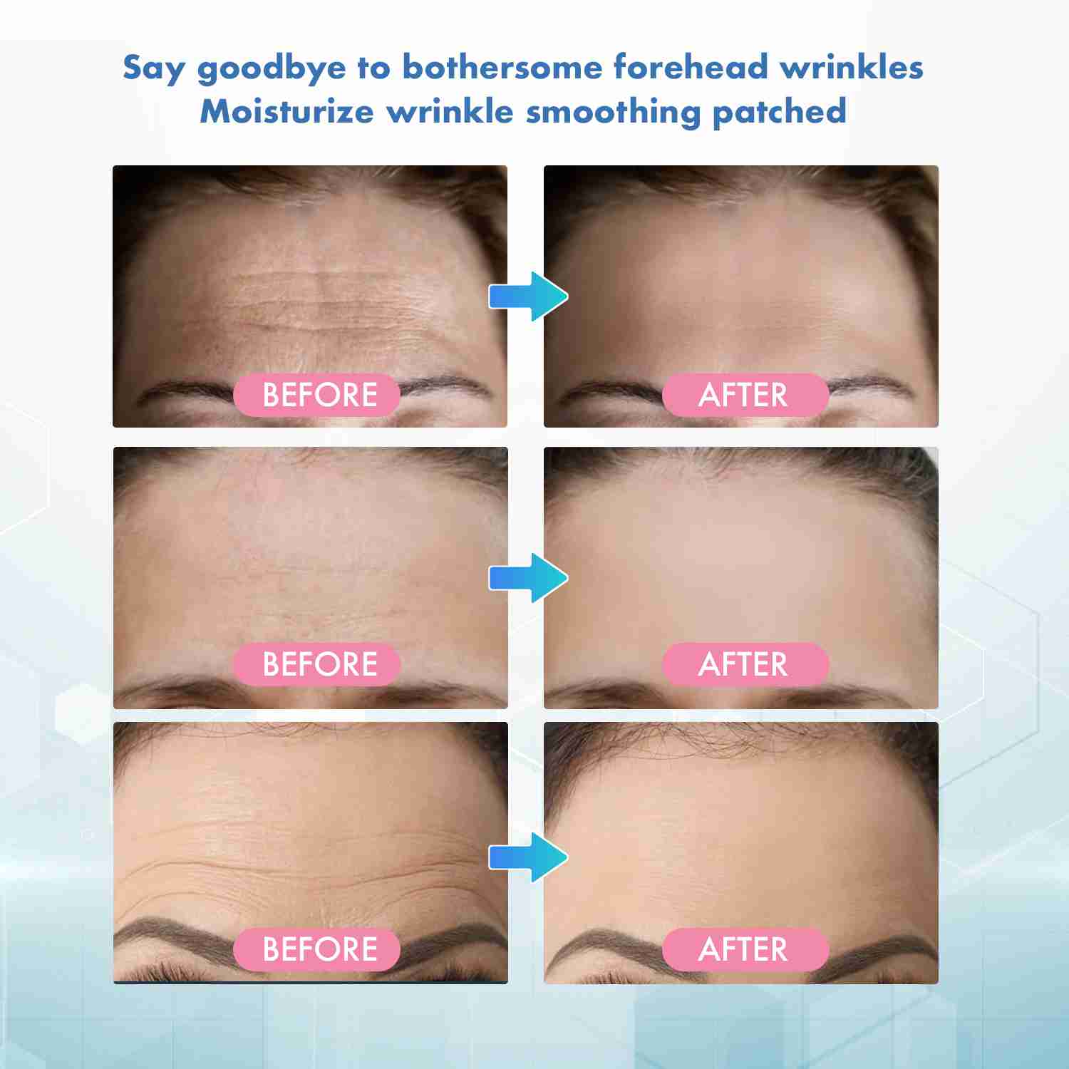forehead-wrinkle-patches with discount code