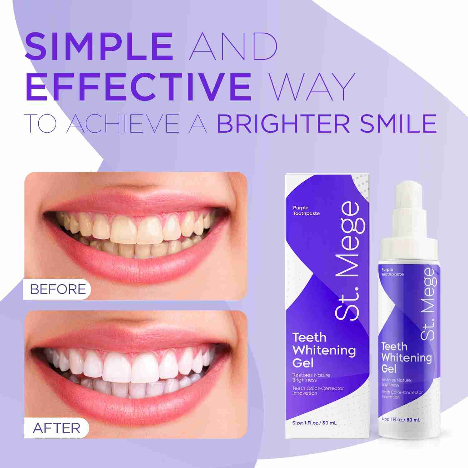 purple-teeth-whitening for cheap