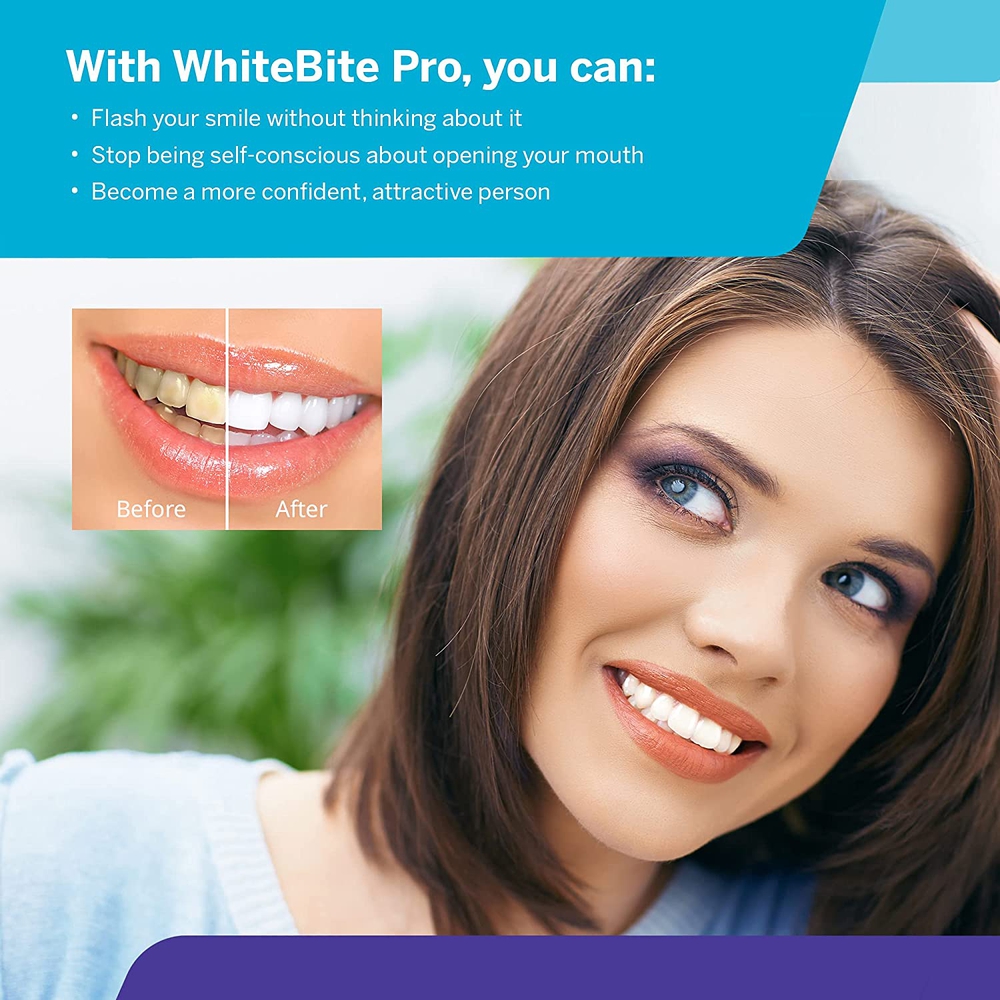 whitebite-pro-teeth-whitening-kit with discount code