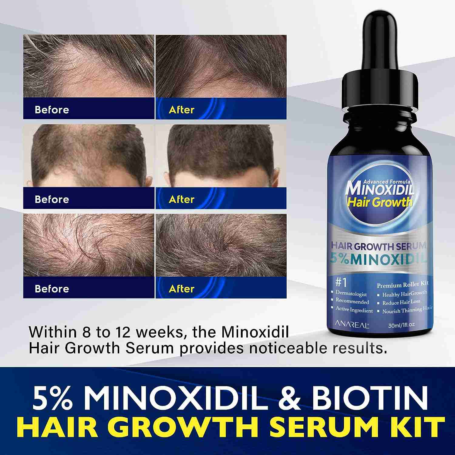minoxidil-for-men-hair-growth with discount code