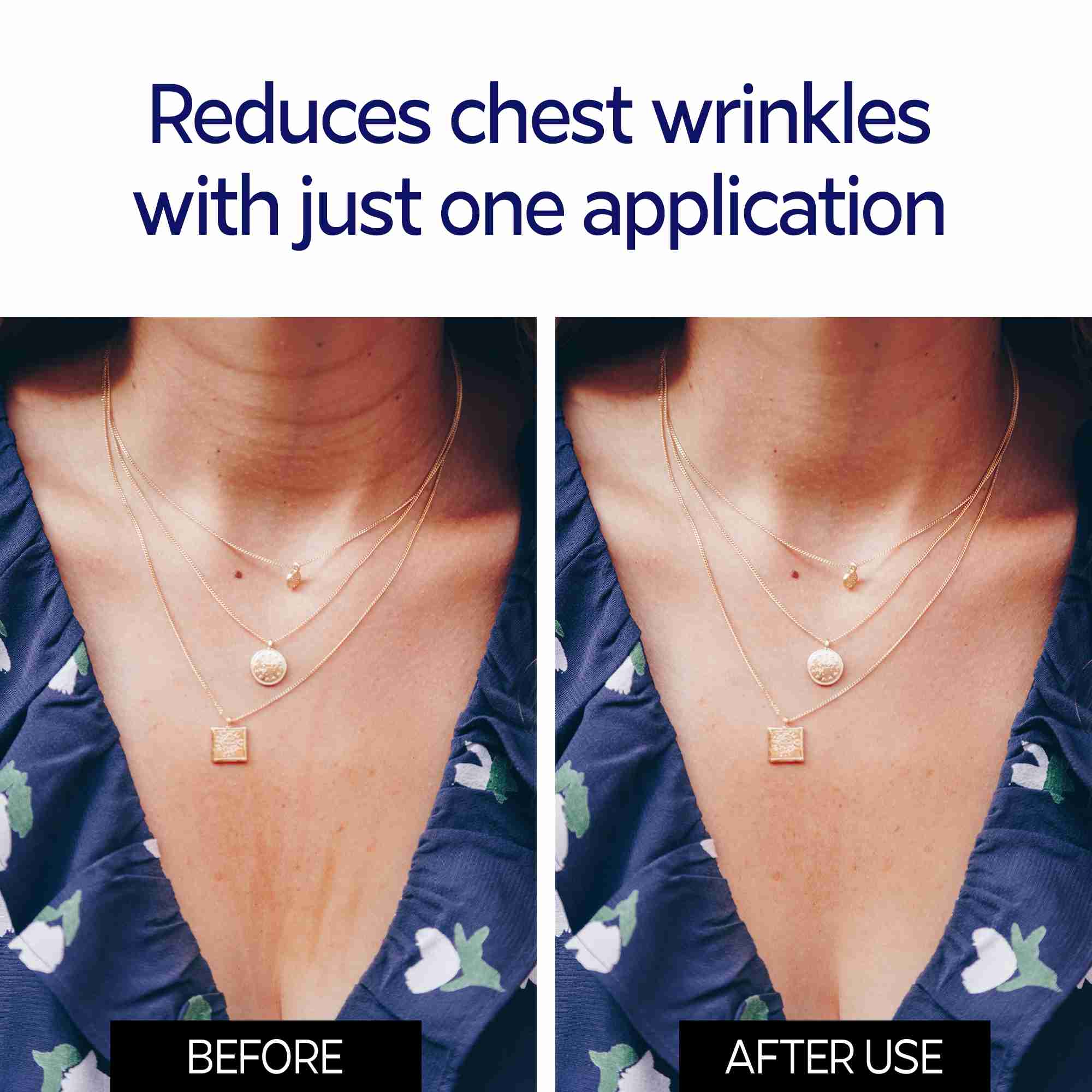 chest-wrinkle-pads for cheap