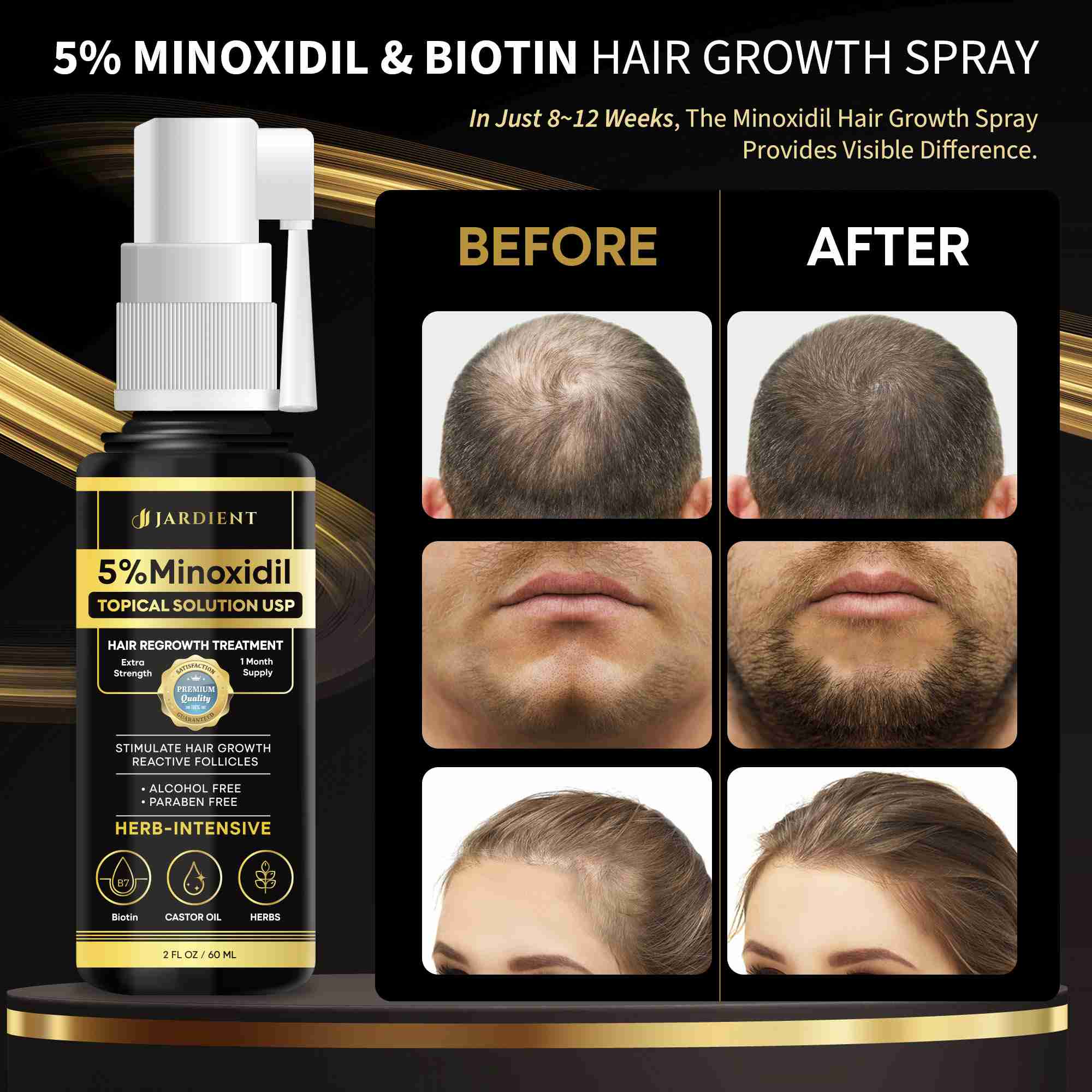 minoxidil-for-women for cheap