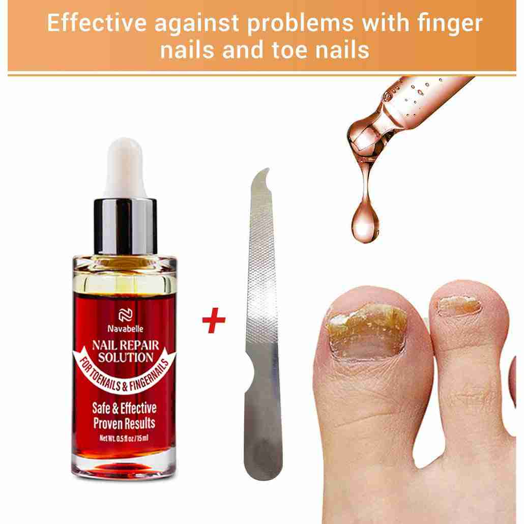 nail-fungus-treatment-for-toenail for cheap