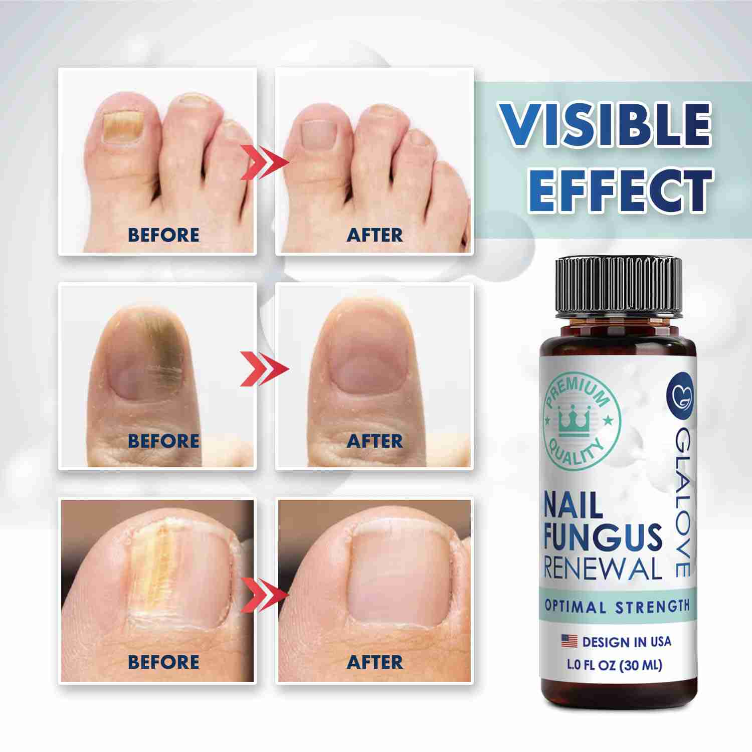 toenail-fungus-treatment-extra-strength with discount code