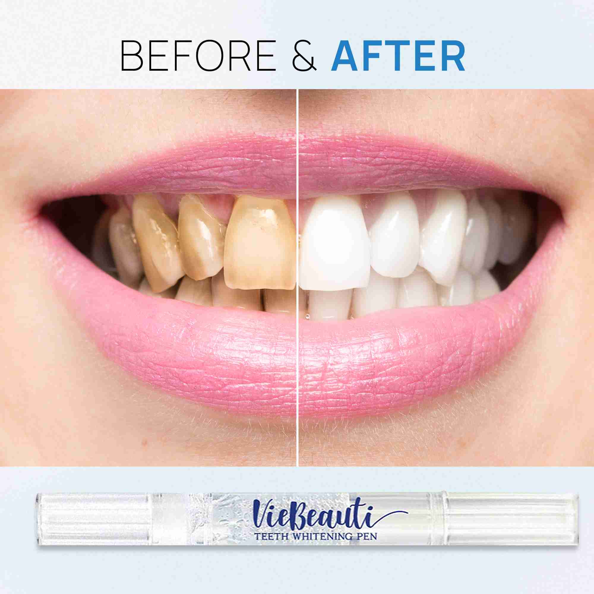 teeth-whitening-pen with discount code